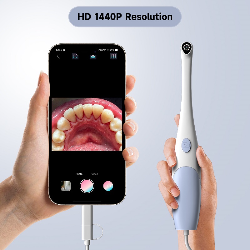 Oral Endoscope Camera 1440P Ph - Photography Lighting Diagram 评论和价格